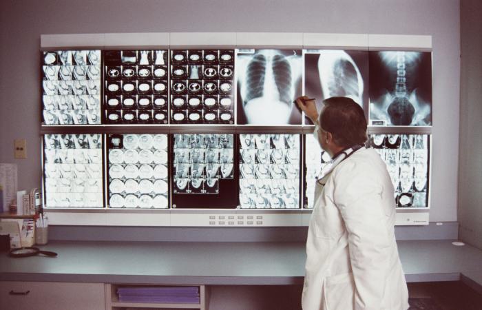 médico analisando radiografias